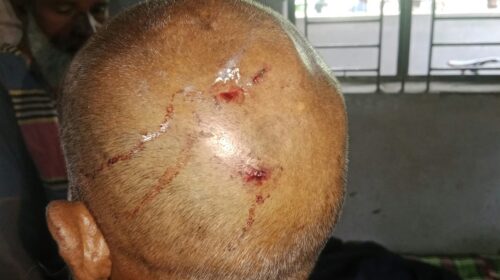 ভালুকায় শিক্ষকের বাড়িতে দুর্ধর্ষ ডাকাতি, লুট ২০ লাখ টাকার মালামাল