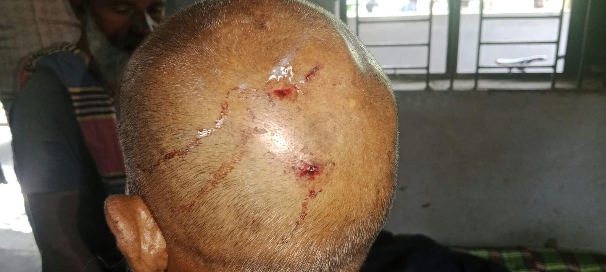 ভালুকায় শিক্ষকের বাড়িতে দুর্ধর্ষ ডাকাতি, লুট ২০ লাখ টাকার মালামাল
